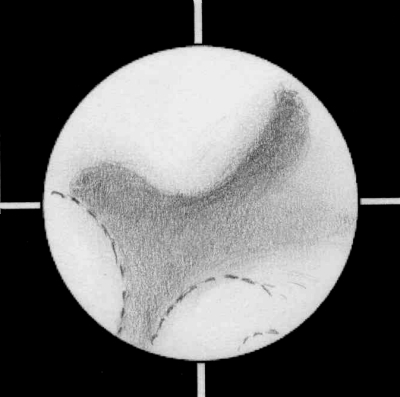 Mars051017